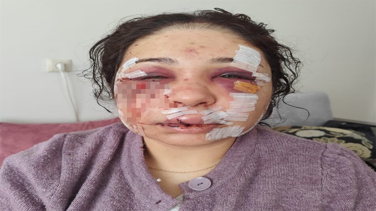 Boşanma sürecindeki eşini darbeden polis memuru savunmasının ardından tahliye edildi